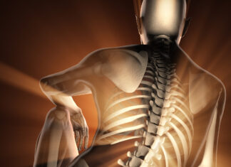 How to Spot Sciatica Sciatica